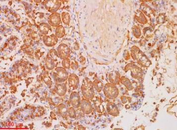 1-13-1-immunohistochemistry-ihc-detection-service-final-1