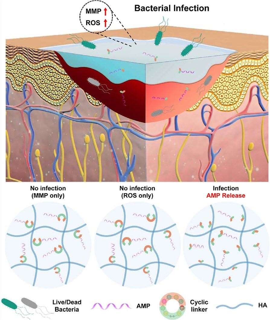 Hydrogel releases antimicrobial peptides in response to matrix metalloproteinases (MMPs) and reactive oxygen species (ROS)