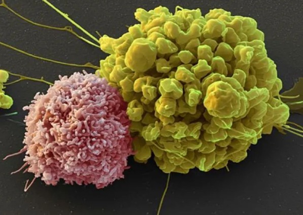 CAR-NK Cell Therapy Development