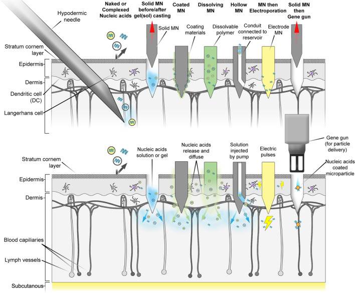 Microneedle system for nucleic acid delivery