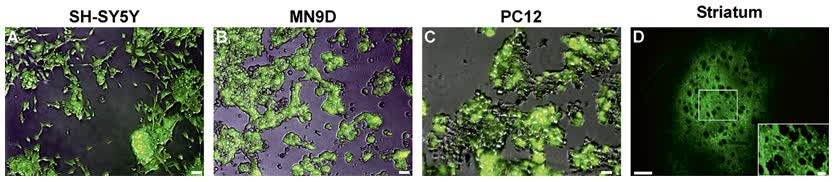 Fig.2 Expression after transduction with lentiviral vectors.