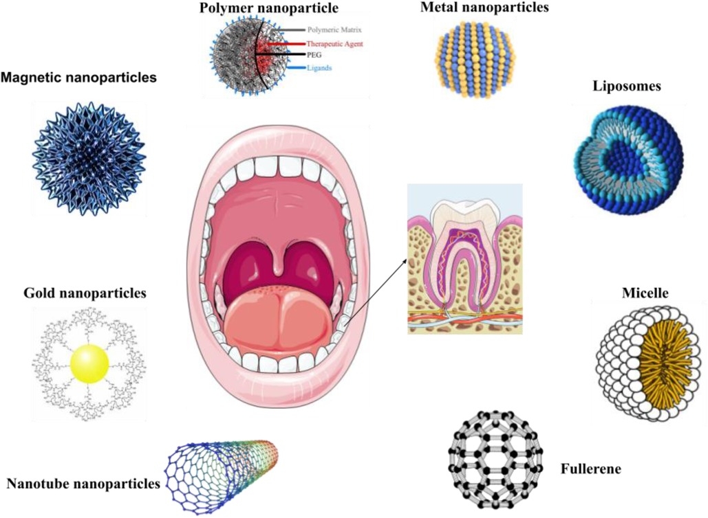 Fig.2 Organic and inorganic nanoparticles in dental care and treatment.