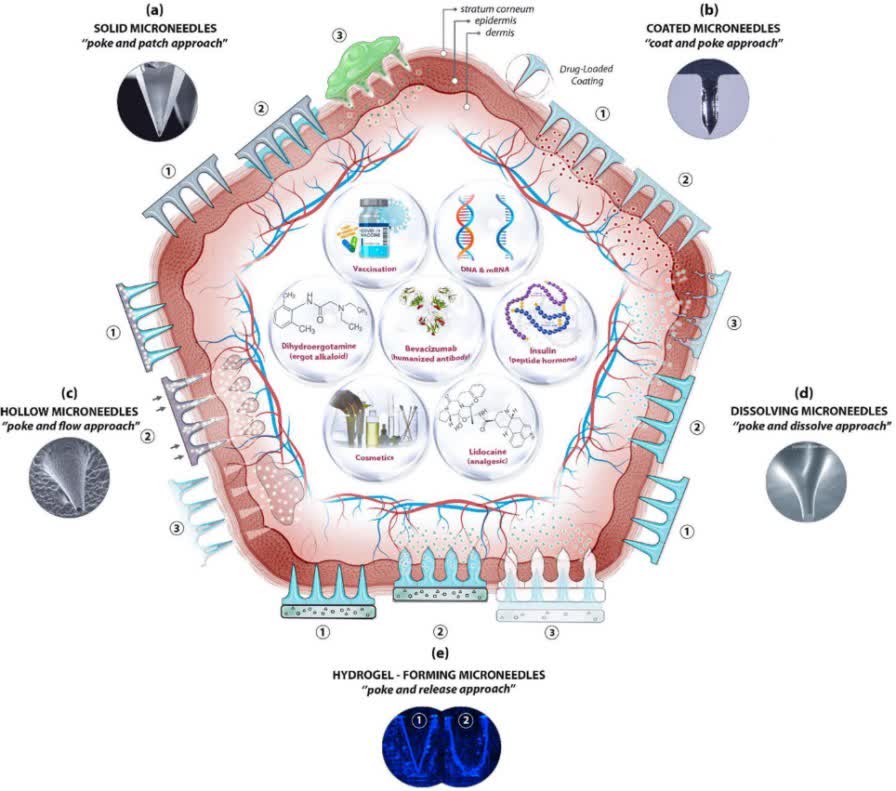 Fig. 1 A schematic diagram of microneedle (MN)-based drug delivery approaches.