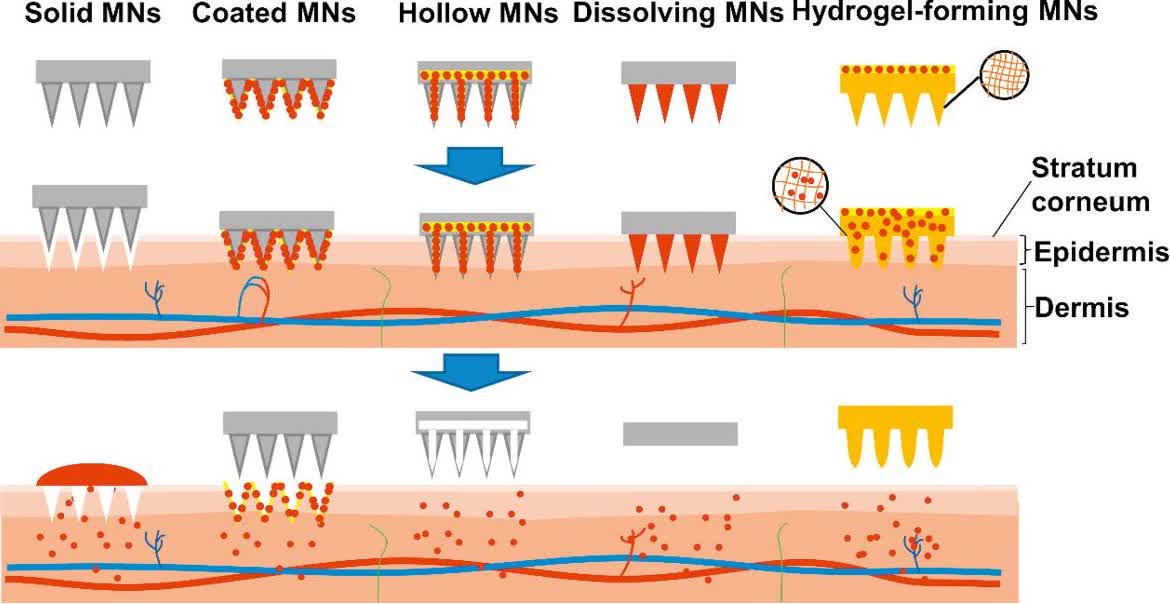 Fig. 2 Types of MNs for proteins/peptides delivery.