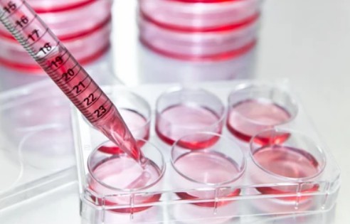 Mammalian Cell Expression Technology