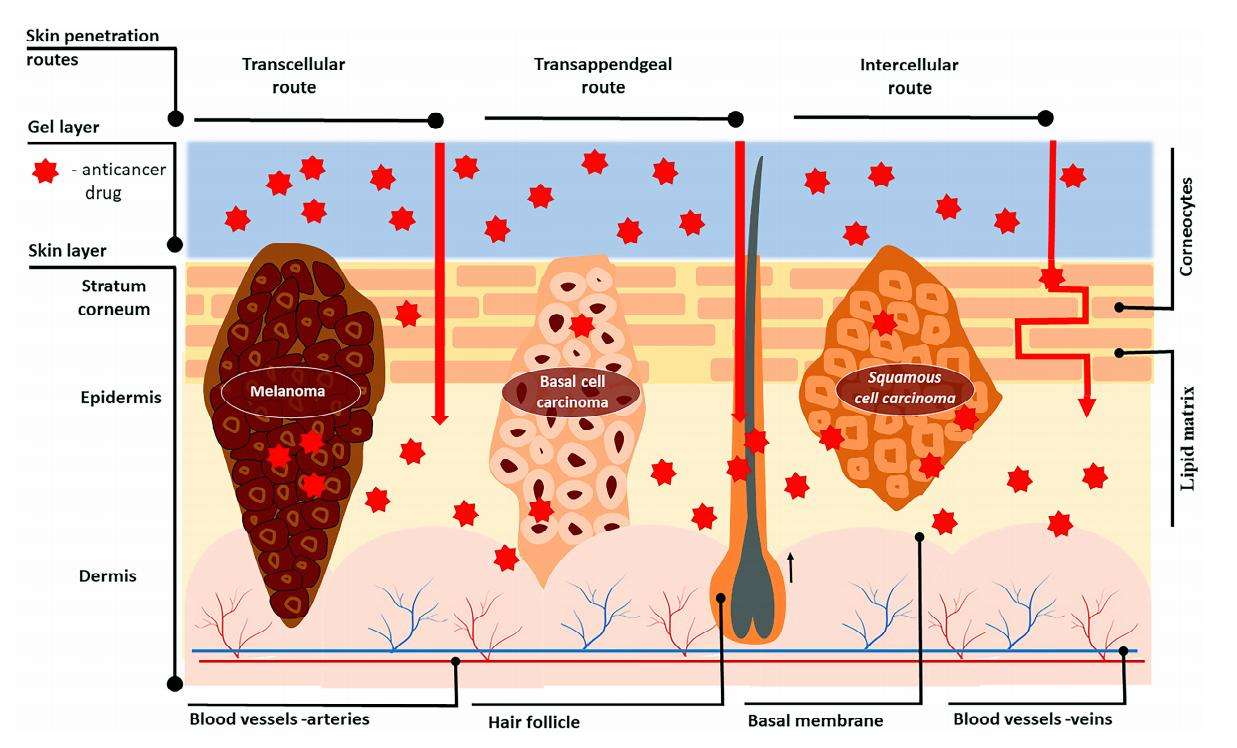 Figure 1. Skin structure and drug transport pathways during topical anticancer treatment.