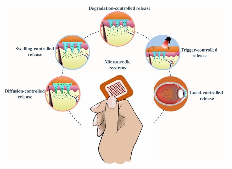 Fig.2 Diagram depicting different strategies for developing polymeric microneedles for controlled drug release.