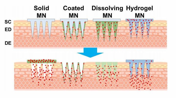 Fig.1 Diagram showing various microneedle types and their drug delivery methods, illustrating the penetration of solid microneedles into skin layers.