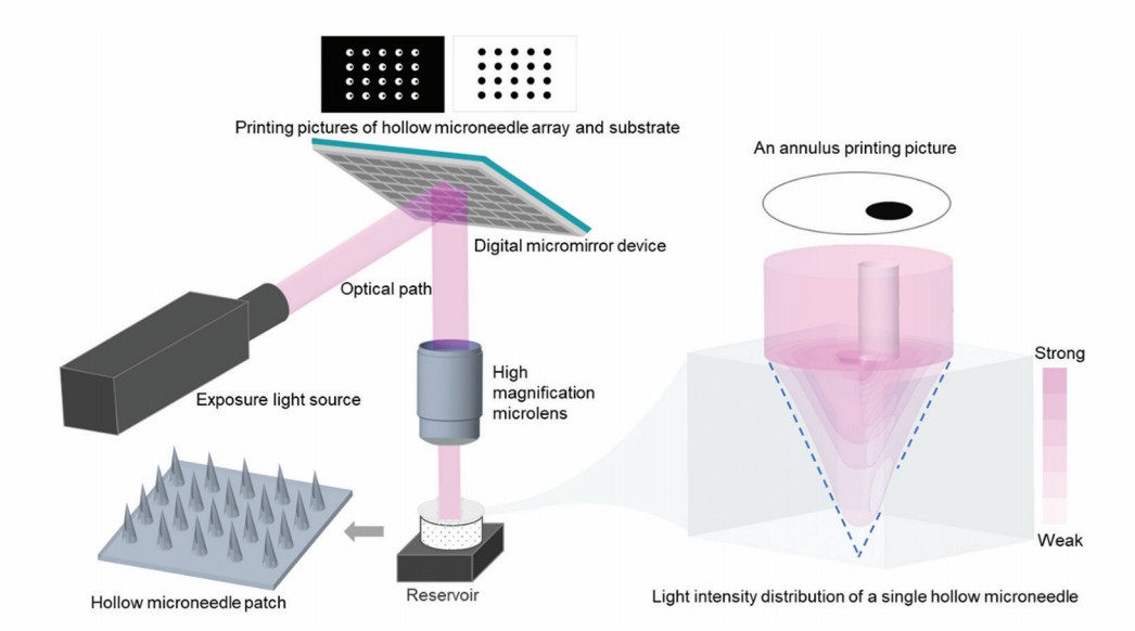 Fig.2 Schematic of hollow microneedle patch fabrication using static optical projection lithography technology.
