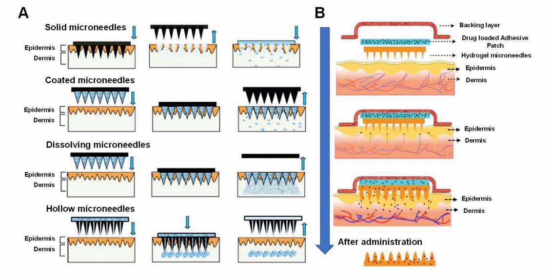 Fig.1 Diagram comparing traditional and hydrogel microneedle drug delivery mechanisms.