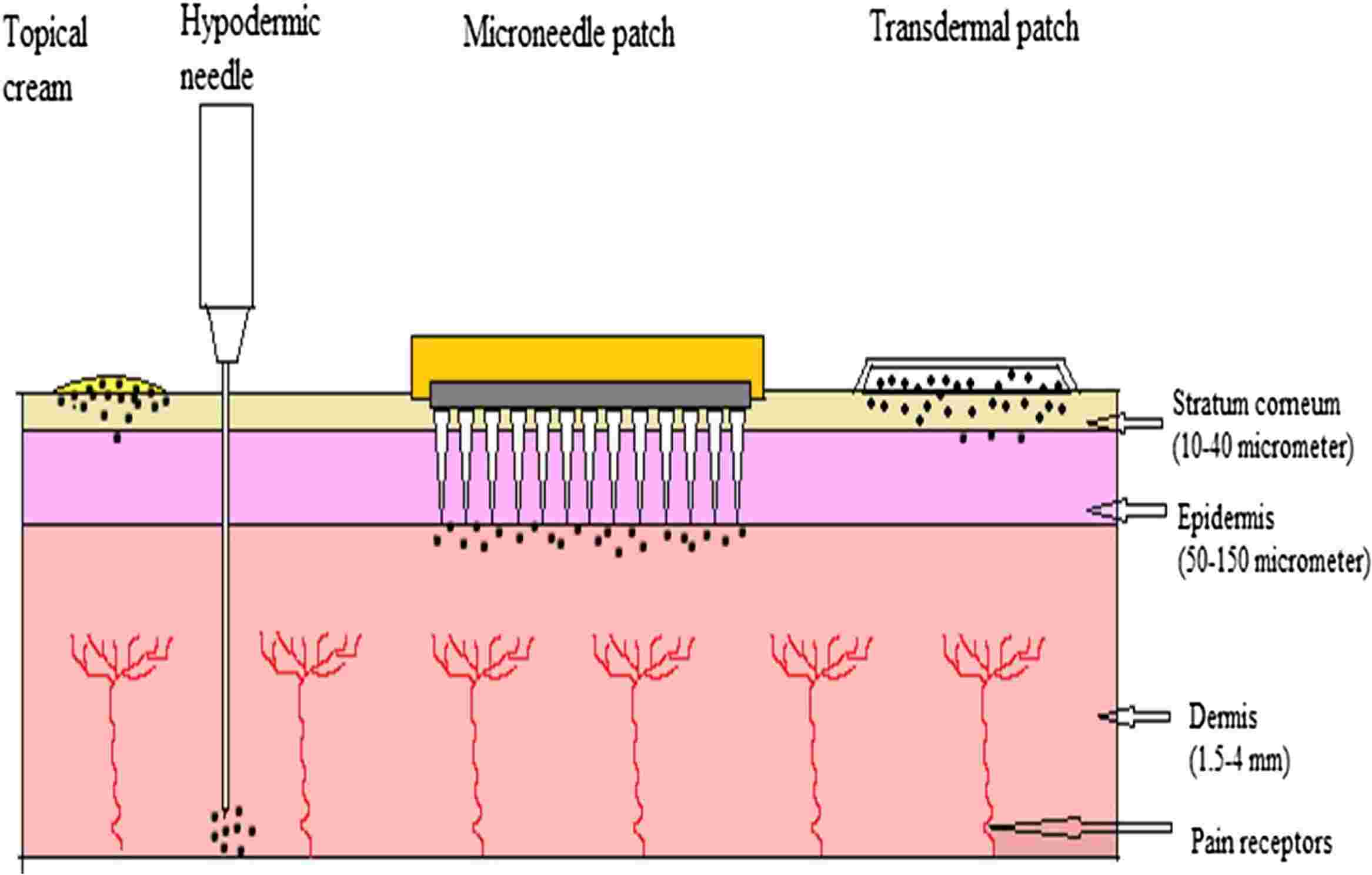 Fig.1 Mechanism of drug delivery by microneedle device.