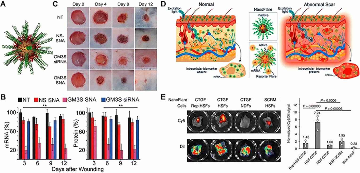 Fig.1 Diagram of Au-based SNAs in wound healing applications, illustrating their delivery of GM3S siRNA for therapeutic effects.
