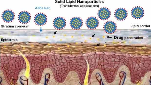 Fig.1 Illustration of solid lipid nanoparticle structure for enhanced dermal drug delivery.