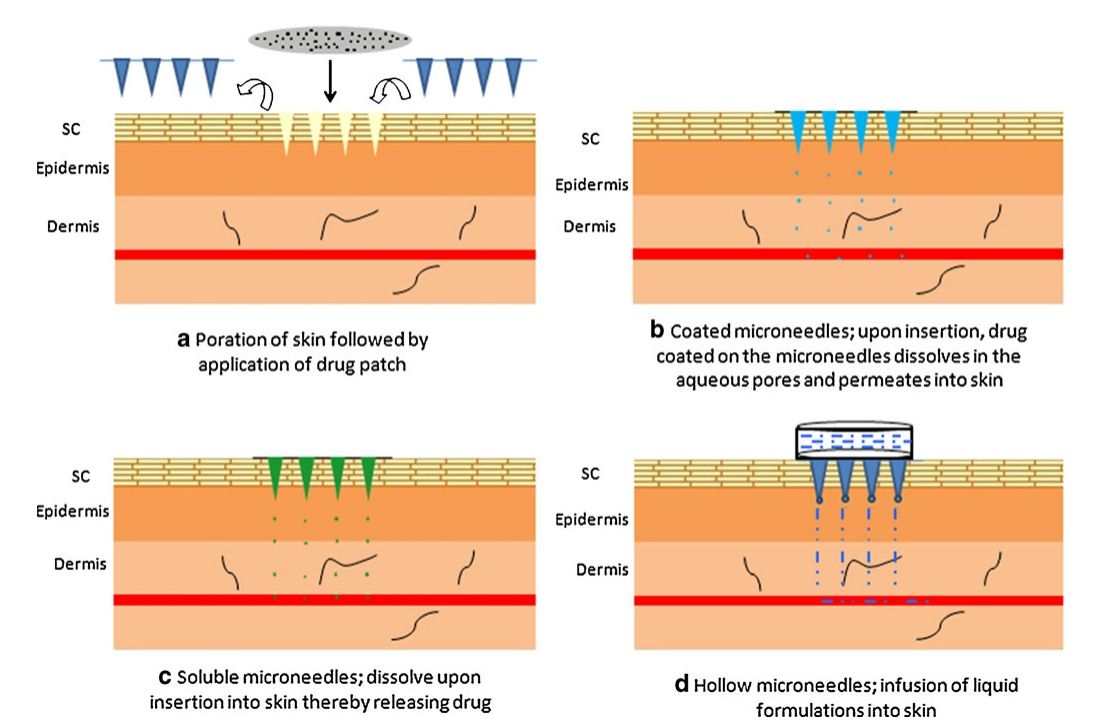 Fig.1 Illustration of various microneedle technology applications for transdermal drug delivery.