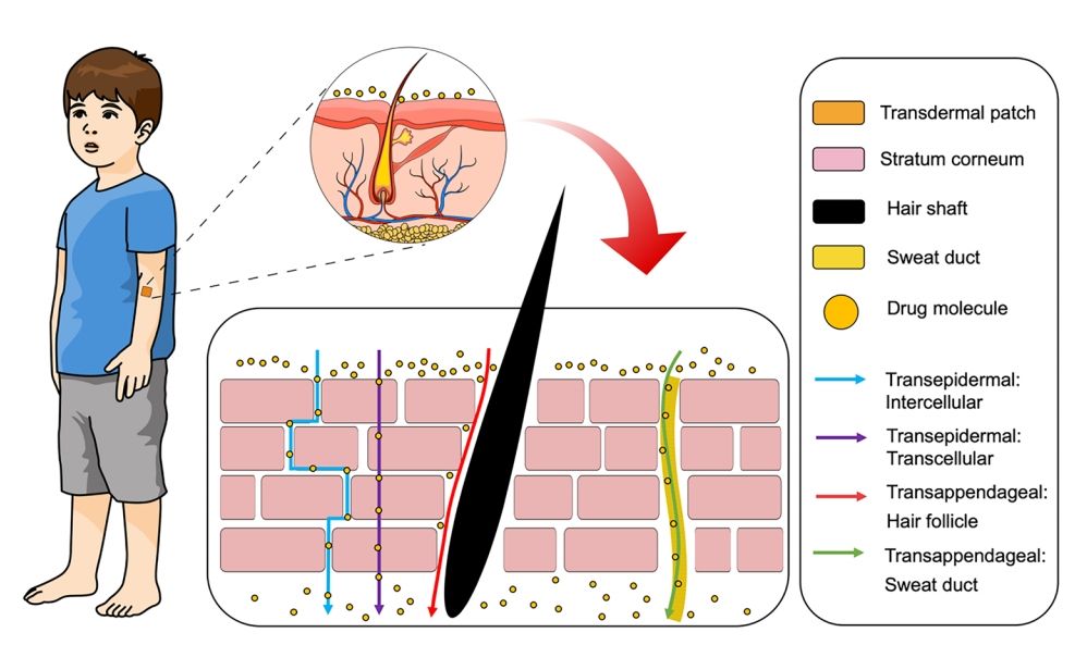Fig. 1 Schematic diagram of transdermal drug delivery mechanisms.