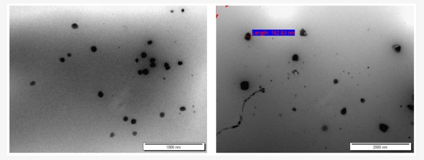 Fig.2 TEM results of niosomal formulation.