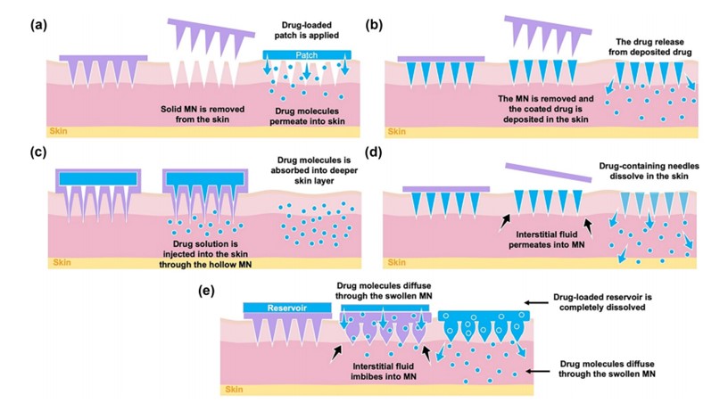 Fig.1 Drug delivery approach via different type of microneedles.