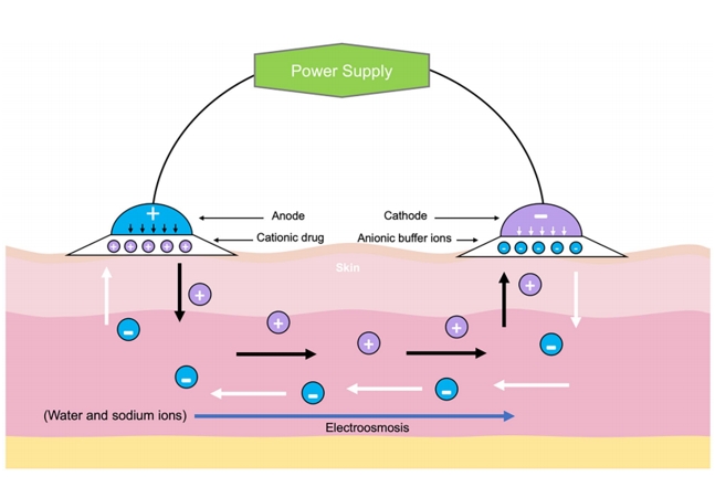 Fig.1 Schematic diagram of cationic drugs using iontophoresis.
