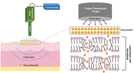 Fig.3 Illustration of electroporation-enhanced transdermal drug delivery reaching the dermis.