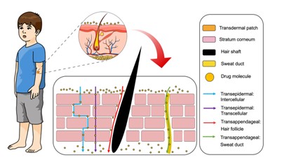 Fig.1 Schematic of transdermal formulation mechanisms.