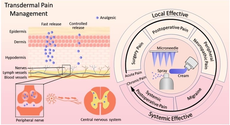 Fig.1 Schematic diagram of transdermal pain management.